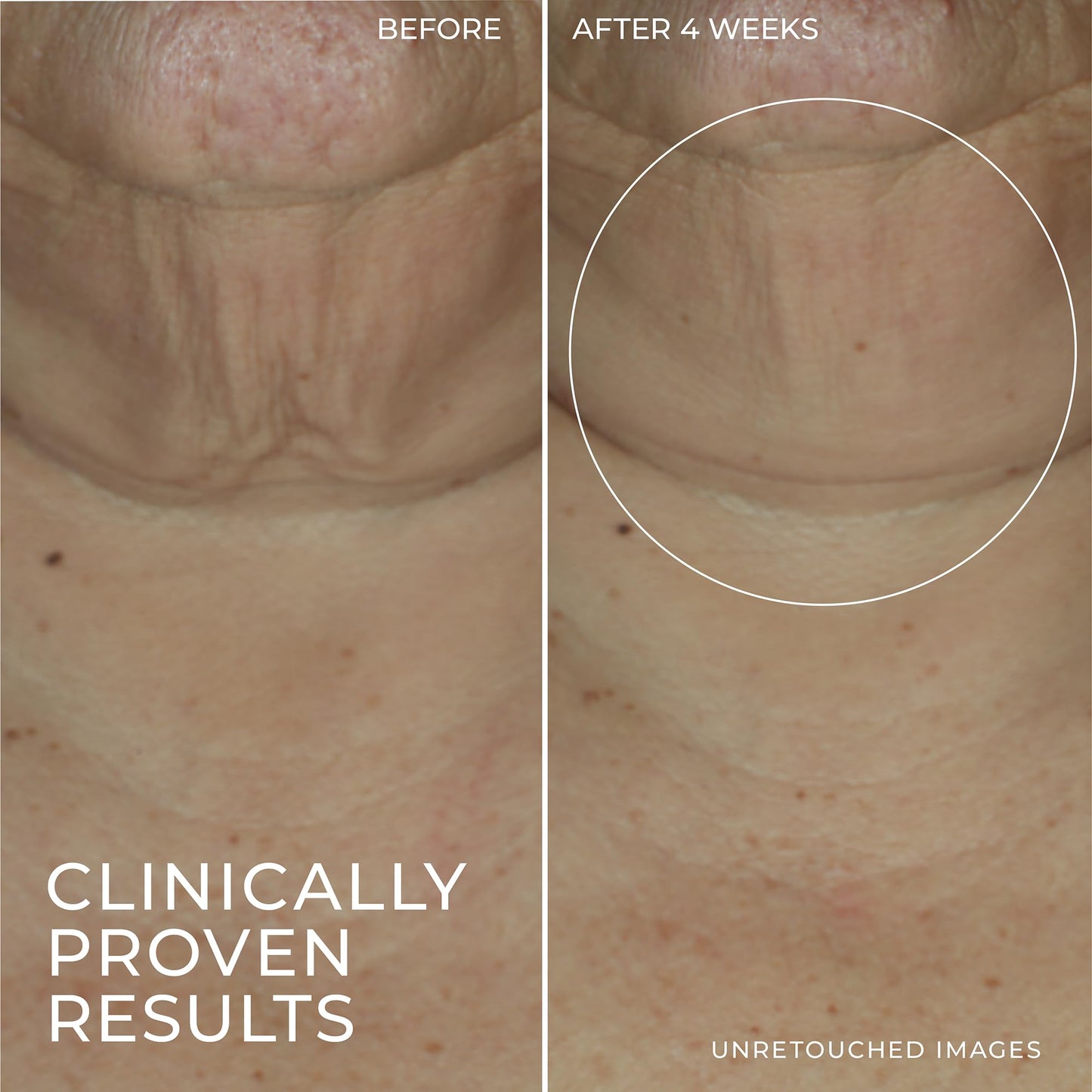 RoC Derm Correxion Retinol Firming Serum Stick 1oz + Retinol Eye Cream Sample – Tightens Wrinkles & Smooths Laugh Lines