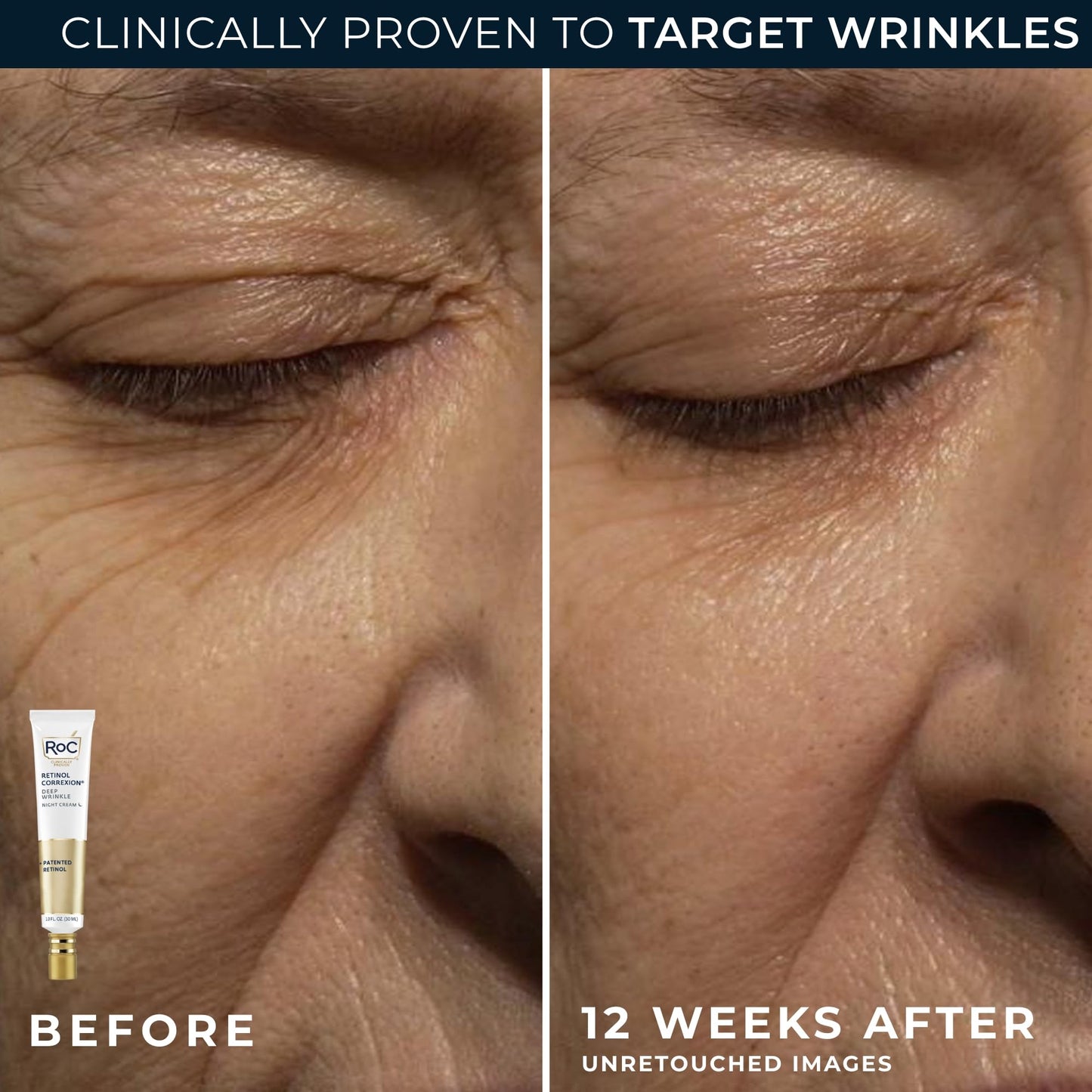 RoC Retinol Correxion Value Set Duo, Deep Wrinkle Anti-Aging Night Face Cream + Under Eye Cream for Dark Circles & Puffiness - Retinol Eye Care