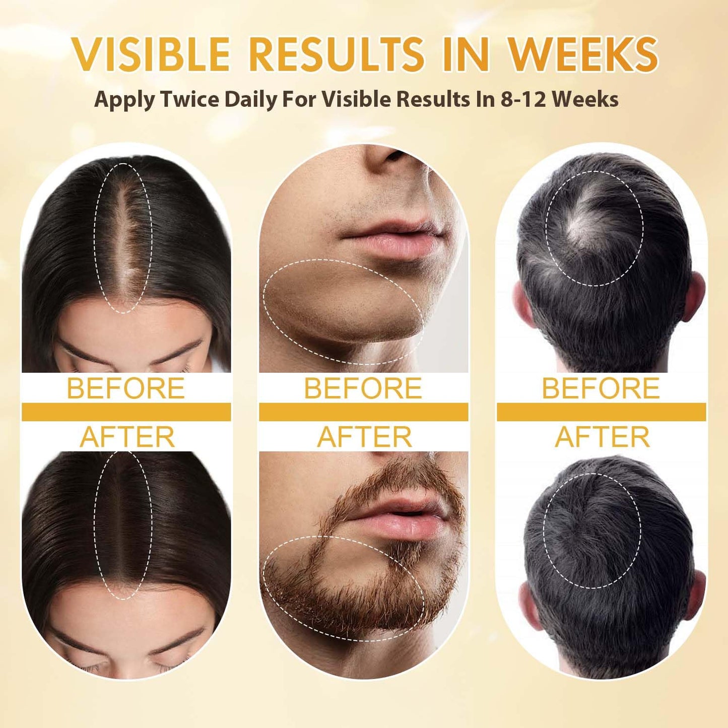 Minoxidil Hair Growth Serum for Men & Women | Biotin, Batana & Rosemary | Extra Strength Hair Regrowth & Hair Loss Treatment, Thicker Fuller Hair