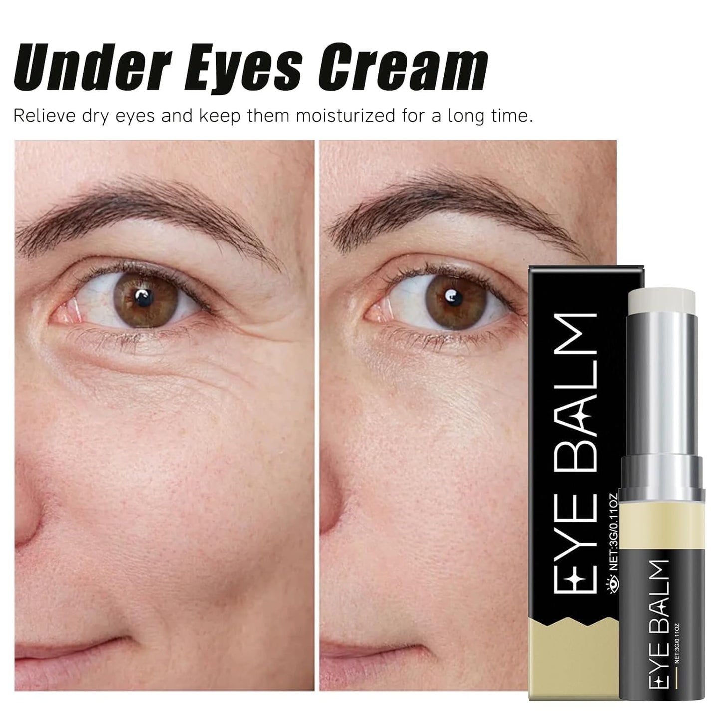 Erases Eye Bags Within Minutes, Under Eye Balm Stick for Under Eyes Bags, Turmeric & Retinol Eye Cream Stick, Erase for Dark Circles Puffiness (2PCS)