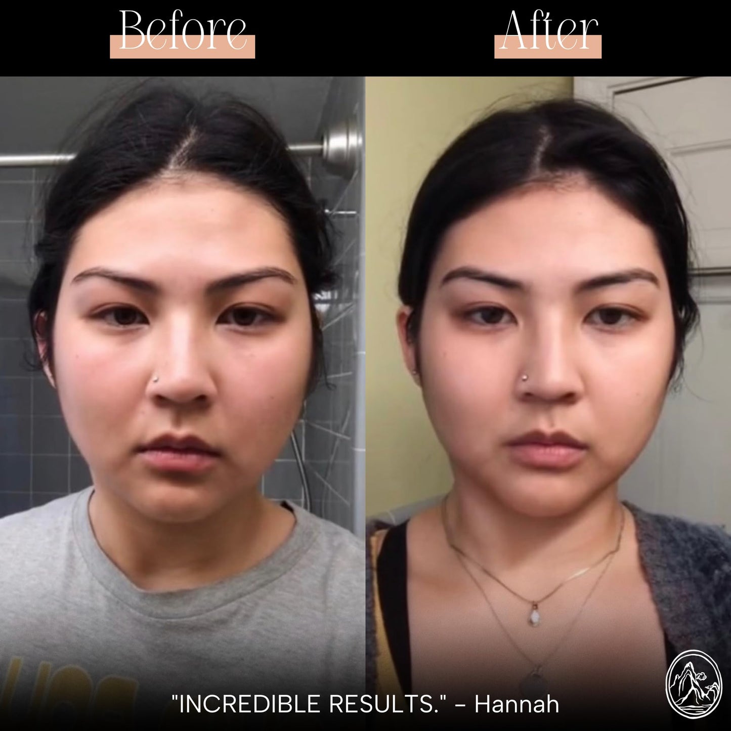 Mount Lai Jade Gua Sha Facial Tool – 100% Genuine Jade for Face Sculpting, Lymphatic Drainage, Puffiness Reduction & Radiance