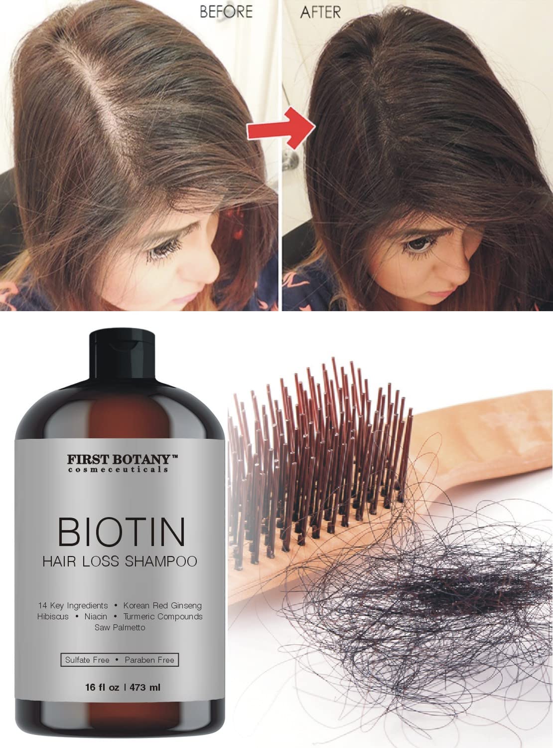 First Botany Hair Regrowth & Anti Hair Loss Shampoo 16 fl oz – DHT Blocker, Hydrating, Detoxifying & Volumizing Formula for Men & Women