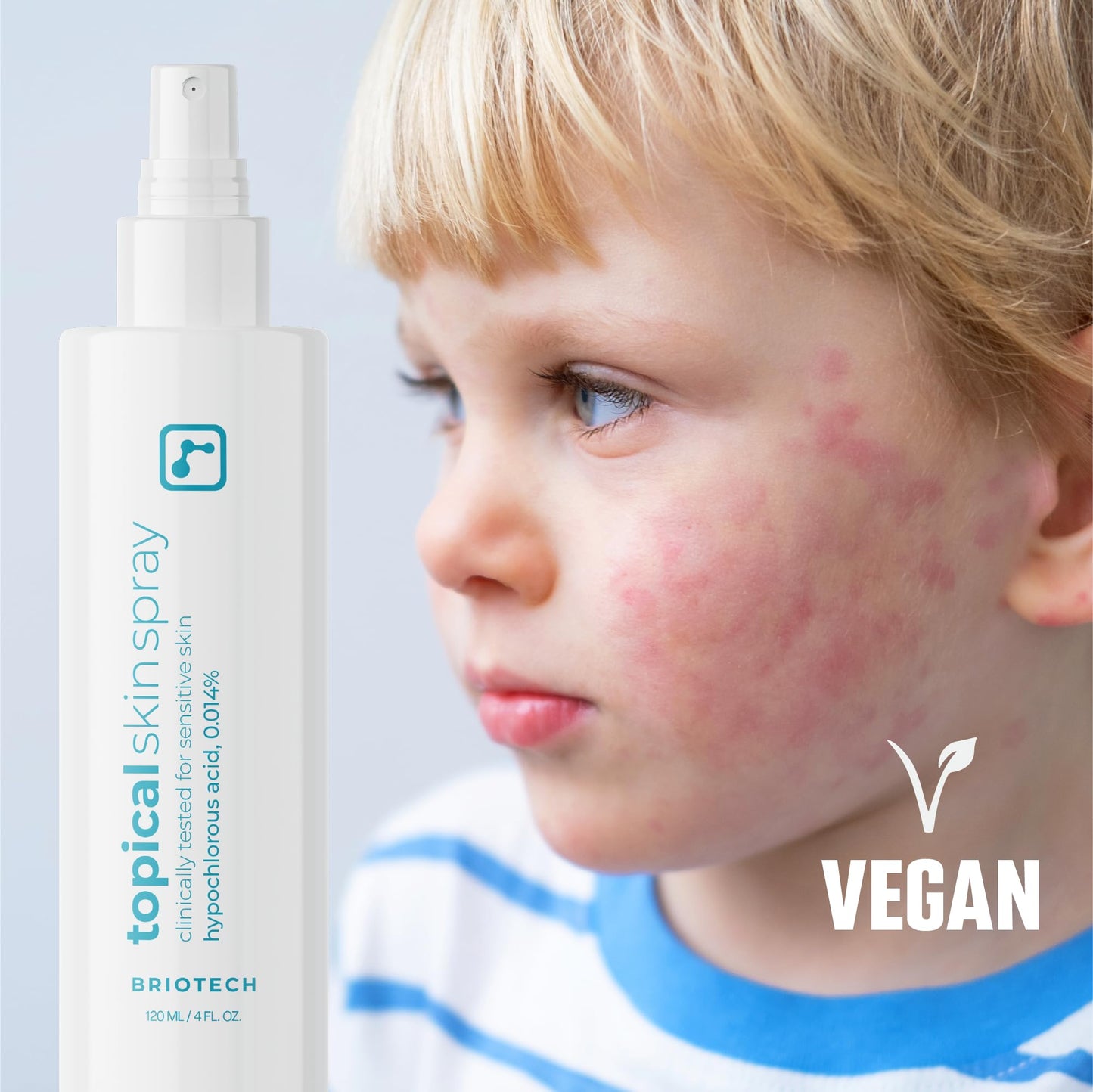 BRIOTECH Hypochlorous Acid Skin Spray – HOCl Facial & Body Mist for Sensitive Skin, Soothes Redness, Irritation, Feet & Scalp, 4 oz