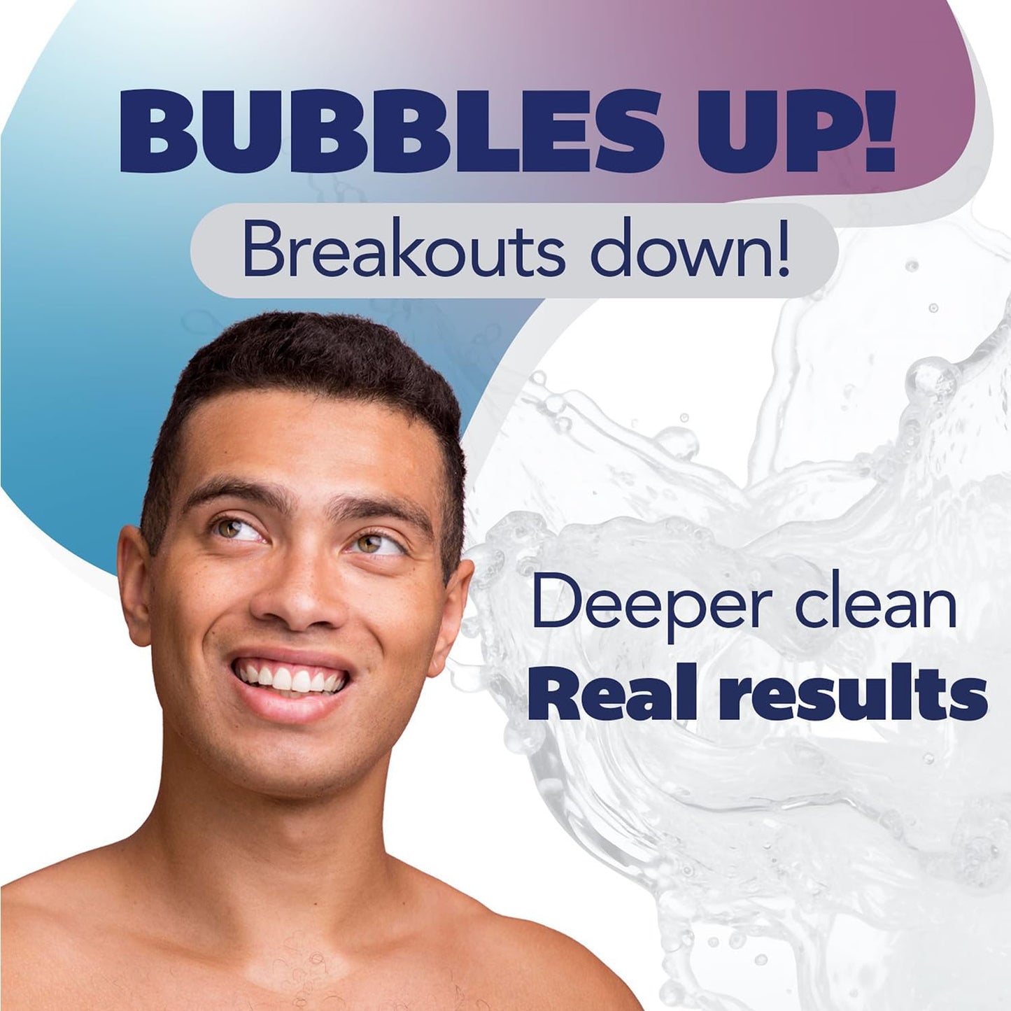 Asepxia Acne Treatment Bar Soap 5-Pack, 1.8% Salicylic Acid, Baking Soda, Deep Cleansing Face Wash for Pimples & Blackheads, 4 Oz