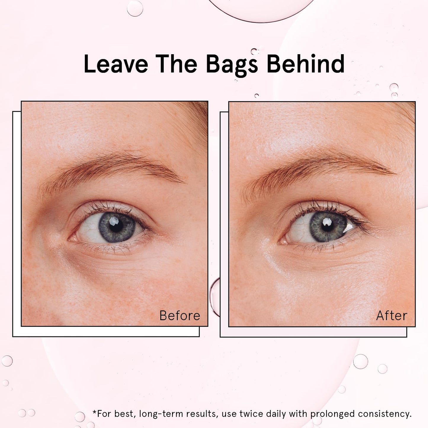 Grace & Stella Under Eye Brightener Roller - Travel Size Eye Serum with Retinol & Caffeine for Puffiness, Dark Circles & Wrinkles, Vegan 15ml