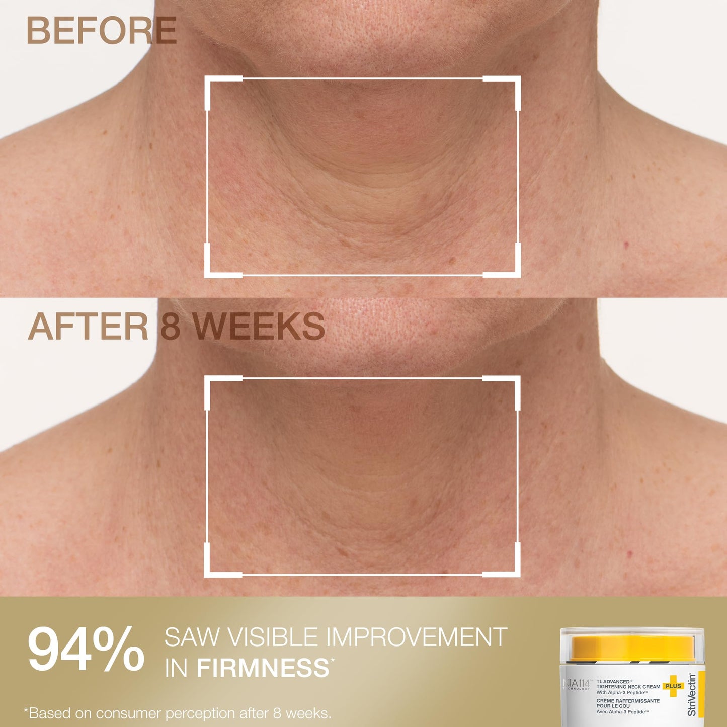 StriVectin Tighten & Smooth Neck Cream and Neck Serum Roller Anti-aging Skin Care 2-Piece Set