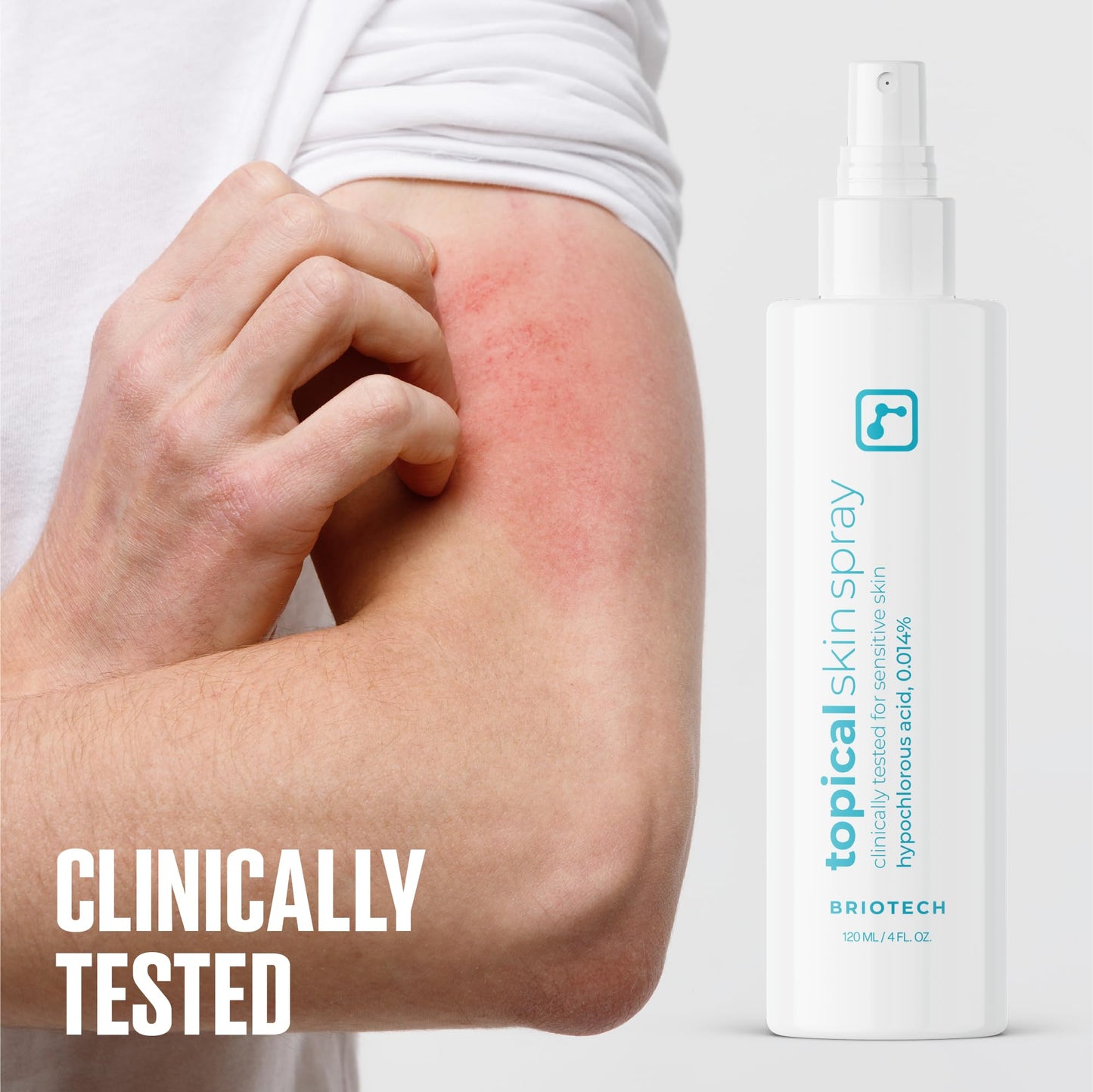 BRIOTECH Hypochlorous Acid Skin Spray – Soothes Redness, Irritation & Sensitive Skin, Facial & Full Body Mist, Foot & Scalp Relief, 8 oz