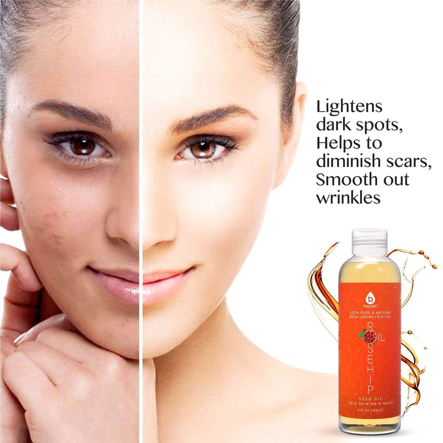 Pursonic 100% Pure Cold-Pressed Rosehip Oil, 6 fl. oz – Hydrating Facial, Hair & Skin Oil for Anti-Aging, Brightening, Scars & Stretch Marks