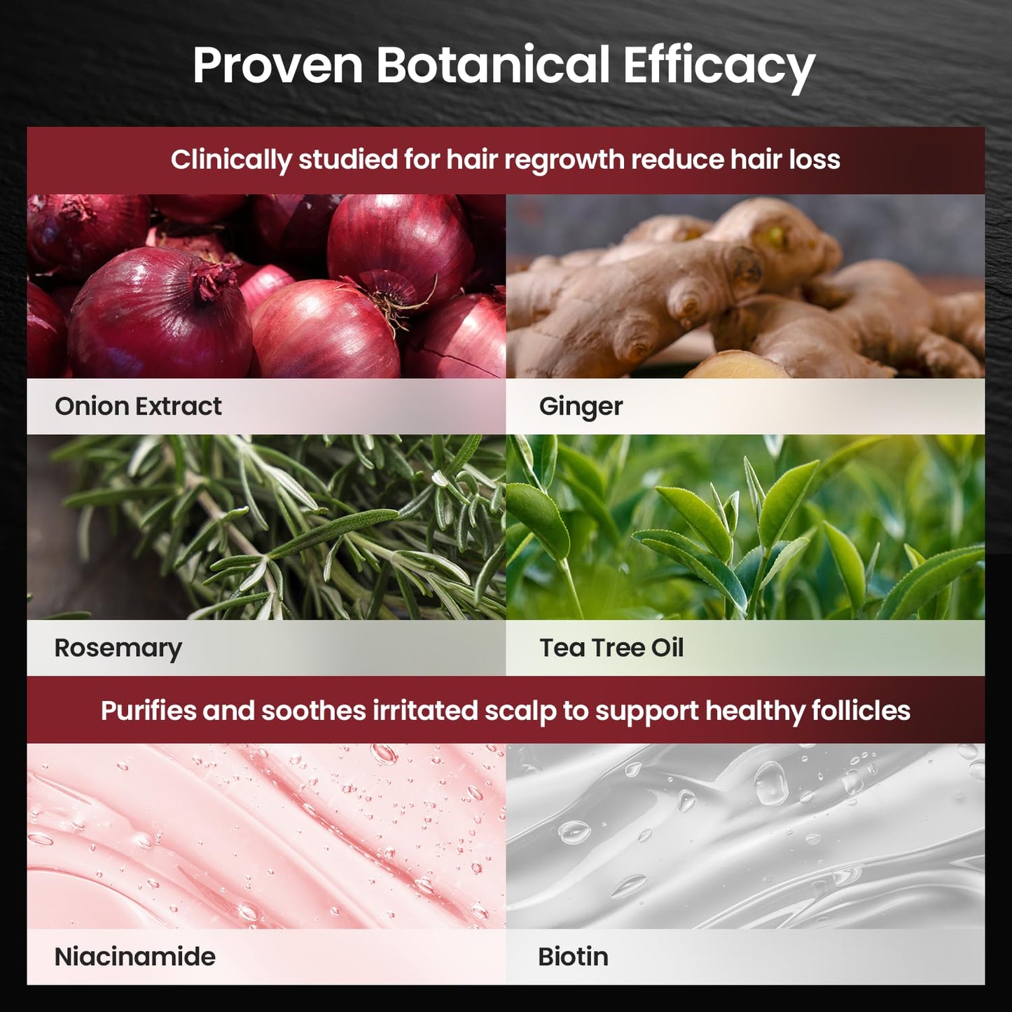 Onion & Biotin Hair Growth Shampoo with Rosemary & Tea Tree Oil – Anti Hair Loss & Thickening Formula for Strong, Healthy Hair (12.5 Fl Oz)