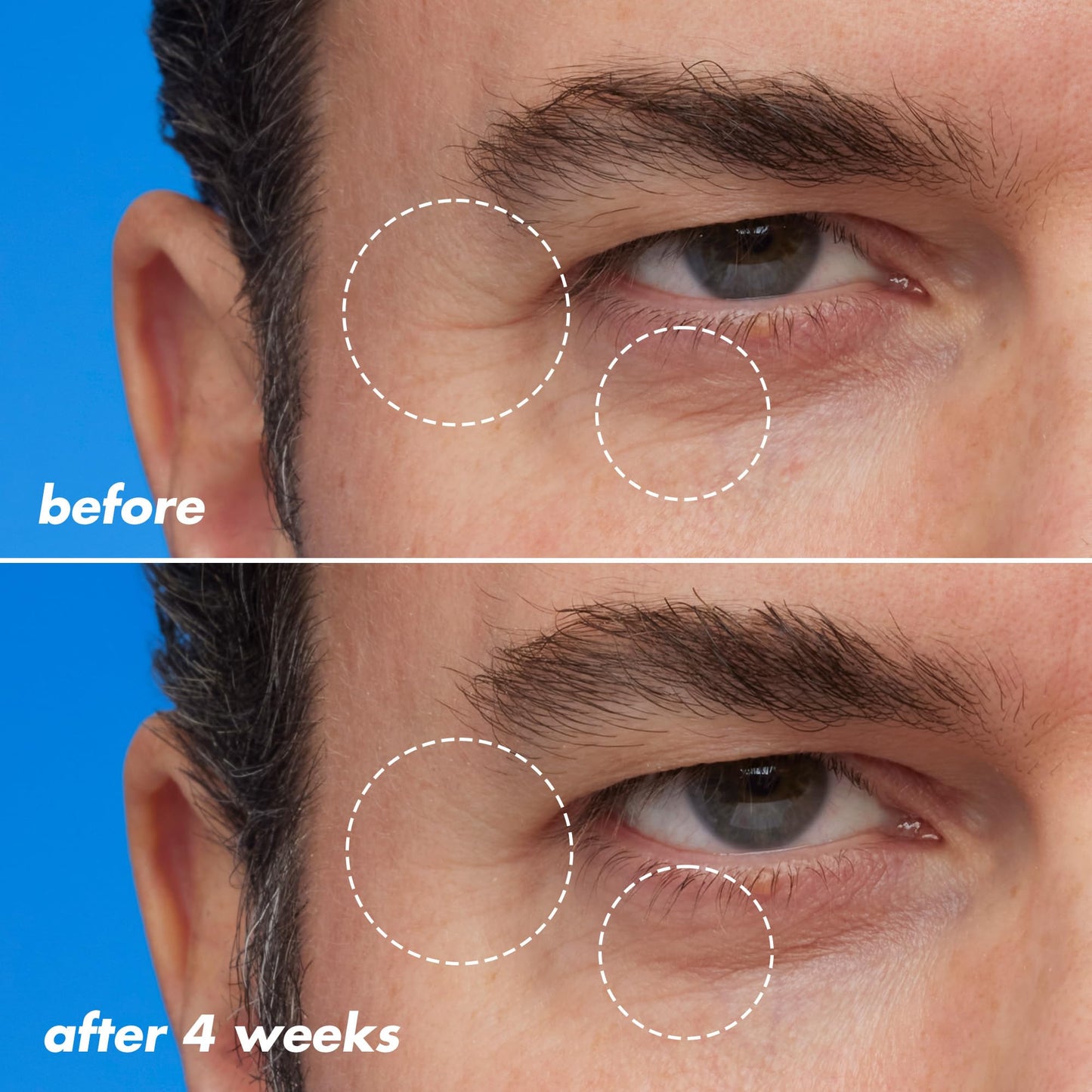 e.l.f. SKIN Youth Boosting Blue-ty Sleep Night Oil, Gentle Overnight Face Oil, Treats Fine Lines & Uneven Texture, Lightweight, Vegan & Cruelty-Free