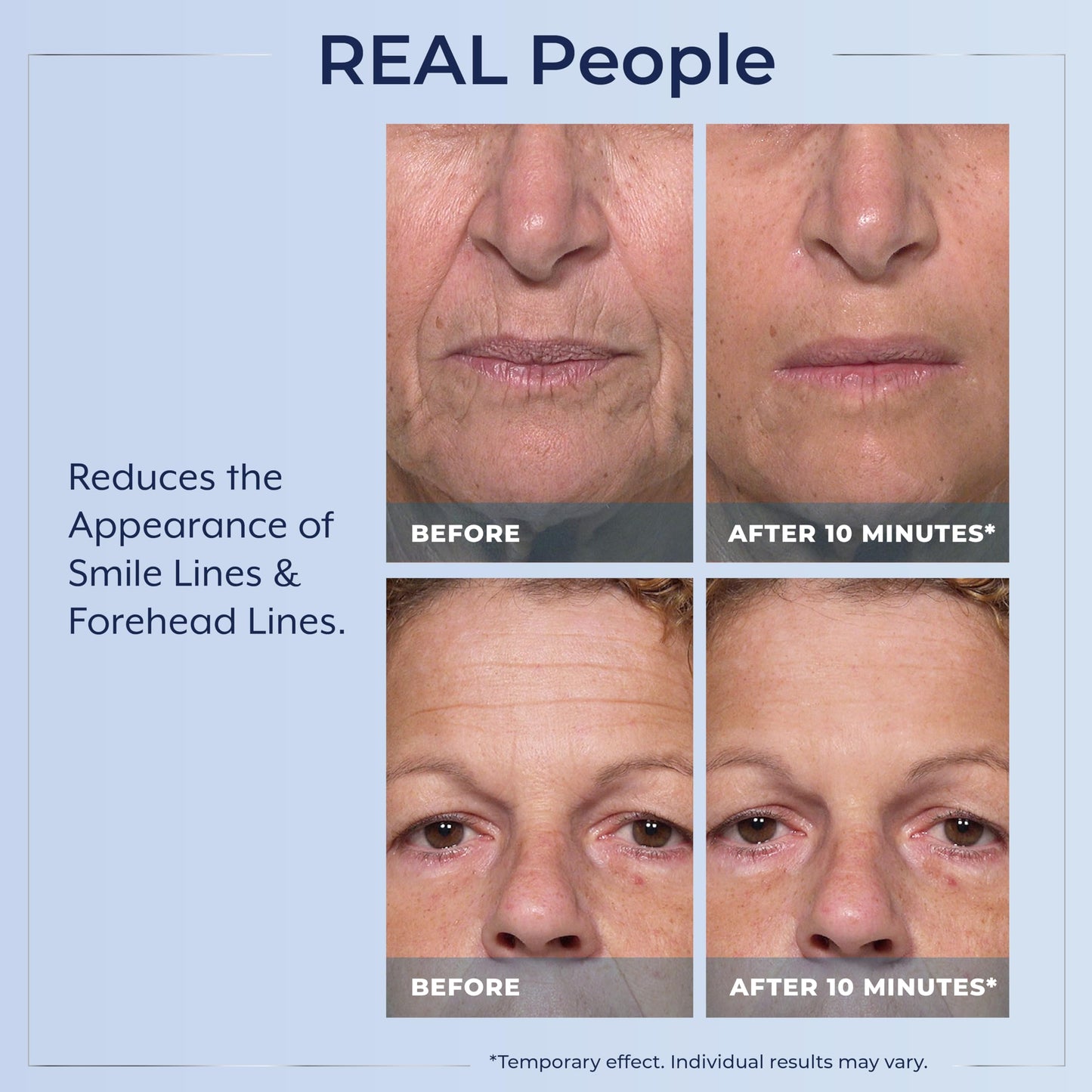 Plexaderm Rapid Reduction Eye Serum – Instantly Reduces Under-Eye Bags, Dark Circles, Wrinkles & Fine Lines, Anti-Aging, Full Size