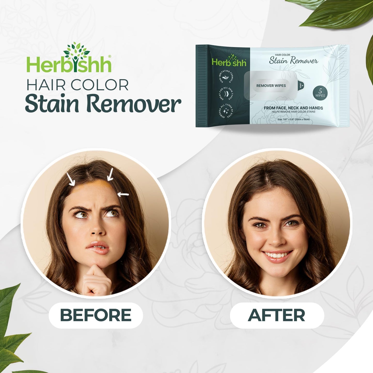 Herbishh Hair Color Stain Remover Wipes - Gentle Formula for Dye Cleanup, Skin-Friendly Travel Pack (Pack of 5)