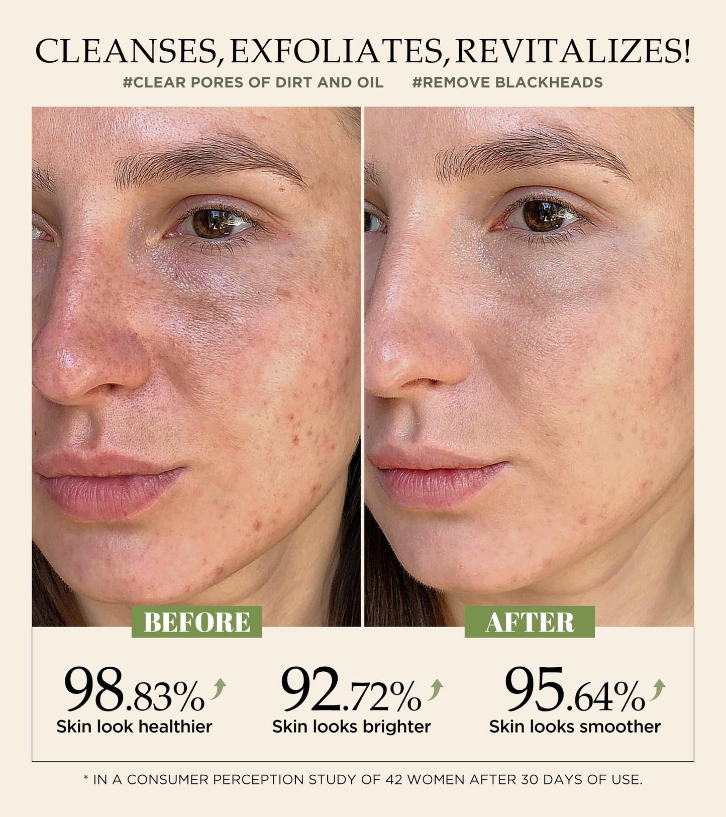 Vitamin C & Turmeric Face Scrub β Exfoliating Scrub for Face & Body, Anti-Aging, Clears Blackheads & Dark Spots, All Skin Types, 4.23 oz