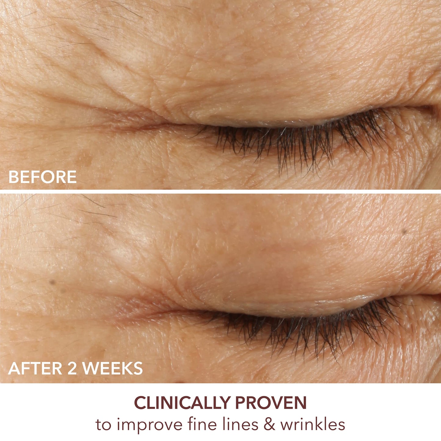 Dr. Dennis Gross Advanced Retinol + Ferulic Eye Serum – Reduces Dark Circles, Puffiness & Wrinkles for Smoother, Youthful Eyes, 0.5 oz