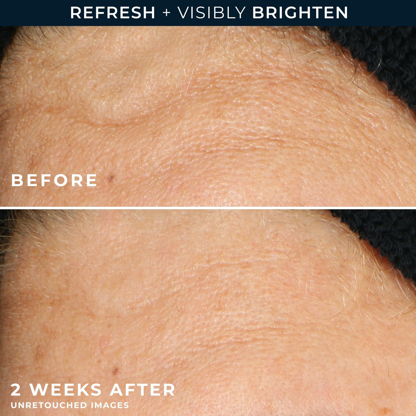 RoC Multi Correxion Revive + Glow Vitamin C Gel Cleanser – Face Wash with Glycolic Acid, Paraben & Sulfate-Free, 6 oz Skincare