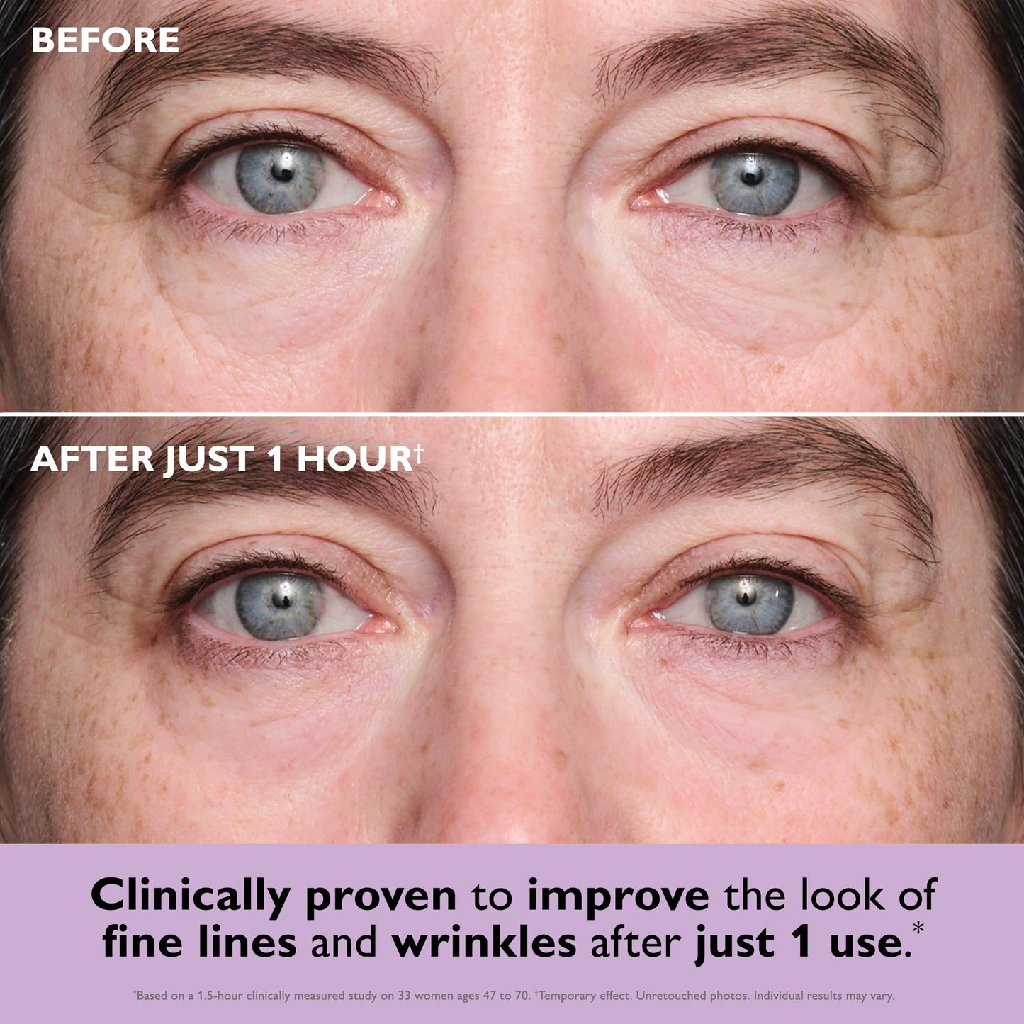 Peter Thomas Roth | Instant FIRMx® Collagen Infusion Tightening Eye Patches