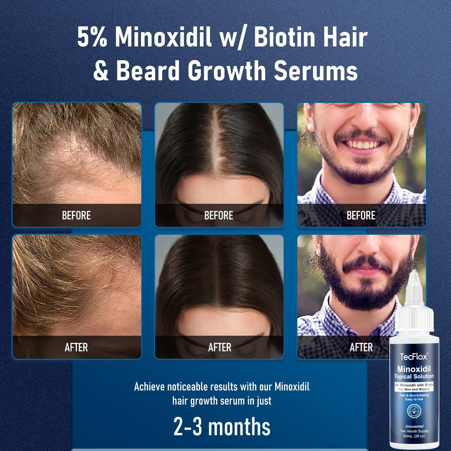 TecFlox 5% Minoxidil with Biotin for Men & Women | Beard & Hair Growth Serum | Unisex 2-Pack (4 fl oz, 4-Month Supply)