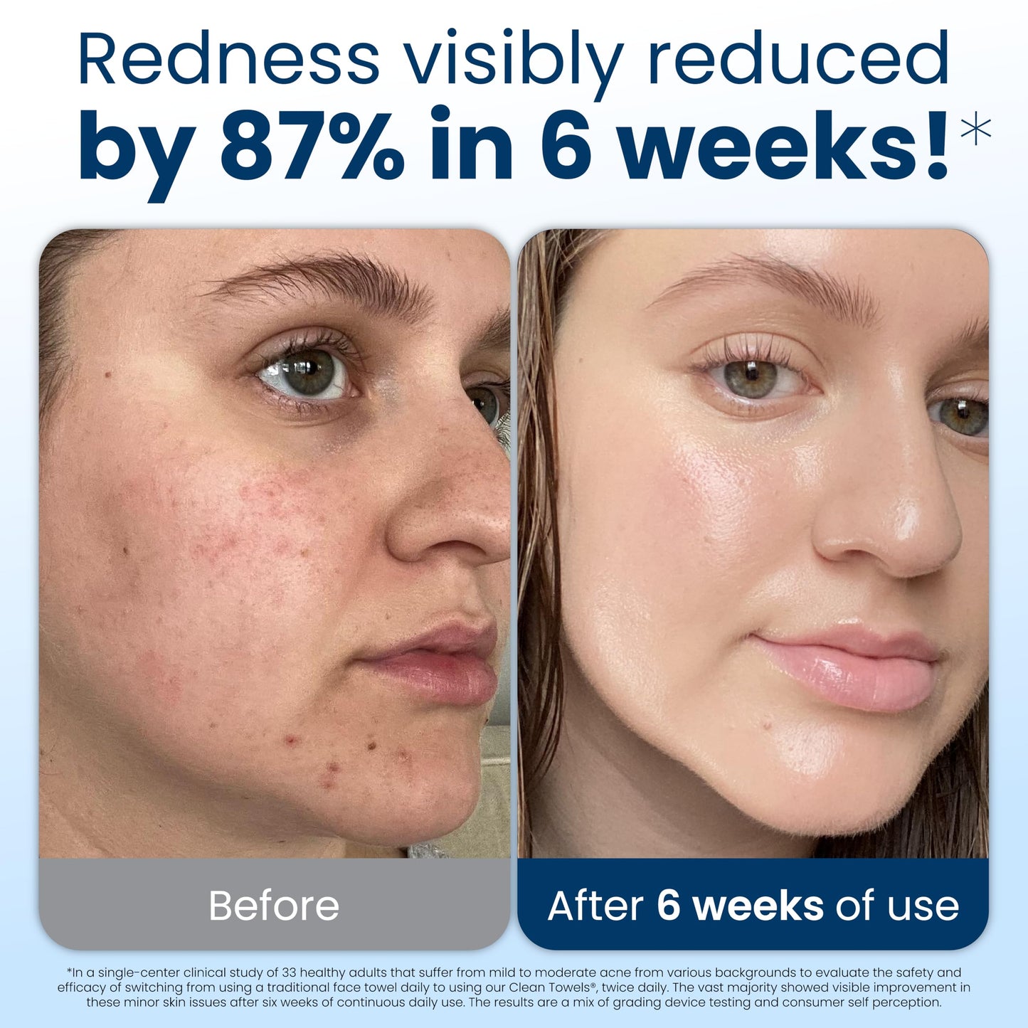 Clean Skin Club Clean Towels XL® – 100% Biobased Disposable Face Towelettes, Eczema-Friendly, Makeup Remover, 30 Count (3 Packs)