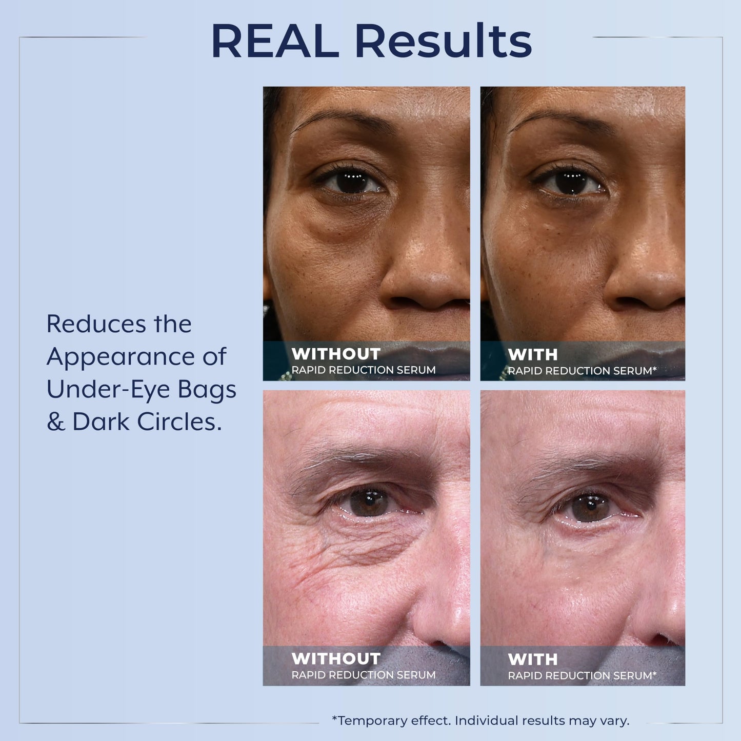 Plexaderm Rapid Reduction Eye Serum – Instantly Reduces Under-Eye Bags, Wrinkles, Dark Circles & Fine Lines, Anti-Aging Pump