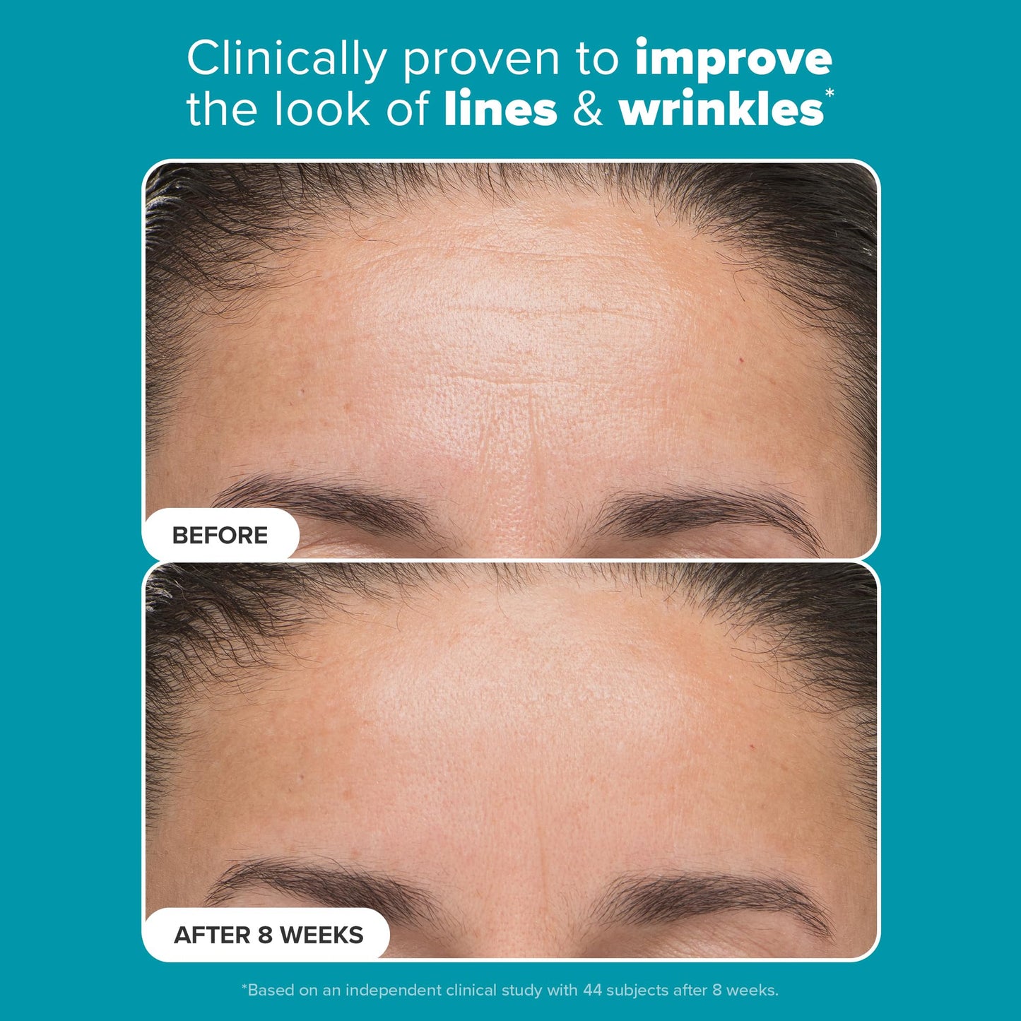 Paula’s Choice Mandelic + Lactic Acid Exfoliant 6%/2% – Gentle Daily AHA for Discoloration, Texture & Radiance, Sensitive Skin, 3 fl oz