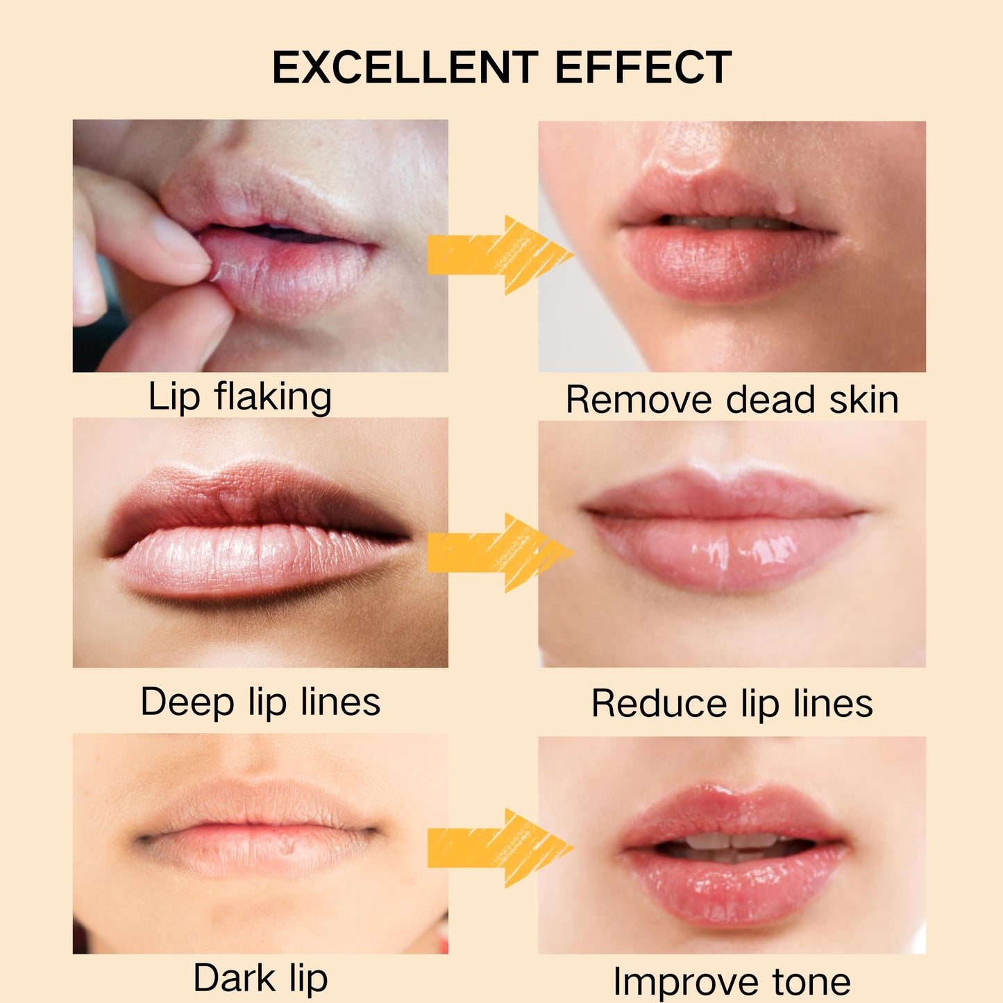 Turmeric & Lemon Lip Care Set – 3PCS Lip Scrub, Balm & Brush for Dry, Chapped, Dark Lips – Exfoliates, Smooths & Nourishes Naturally