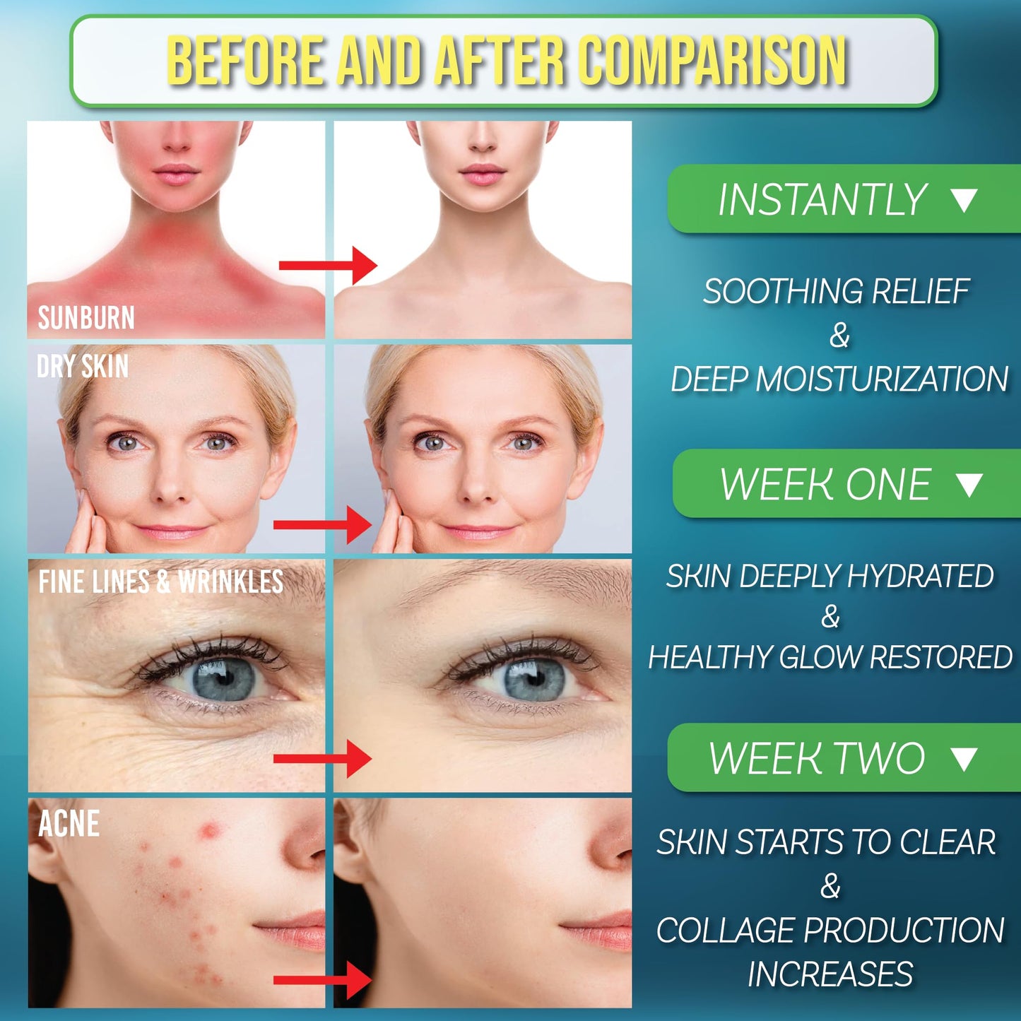 Green Leaf Naturals Aloe Vera Spray 99% Cold-Pressed with Vitamins C, E & A – Skin, Hair, Face Moisturizer & Sunburn Relief 8oz