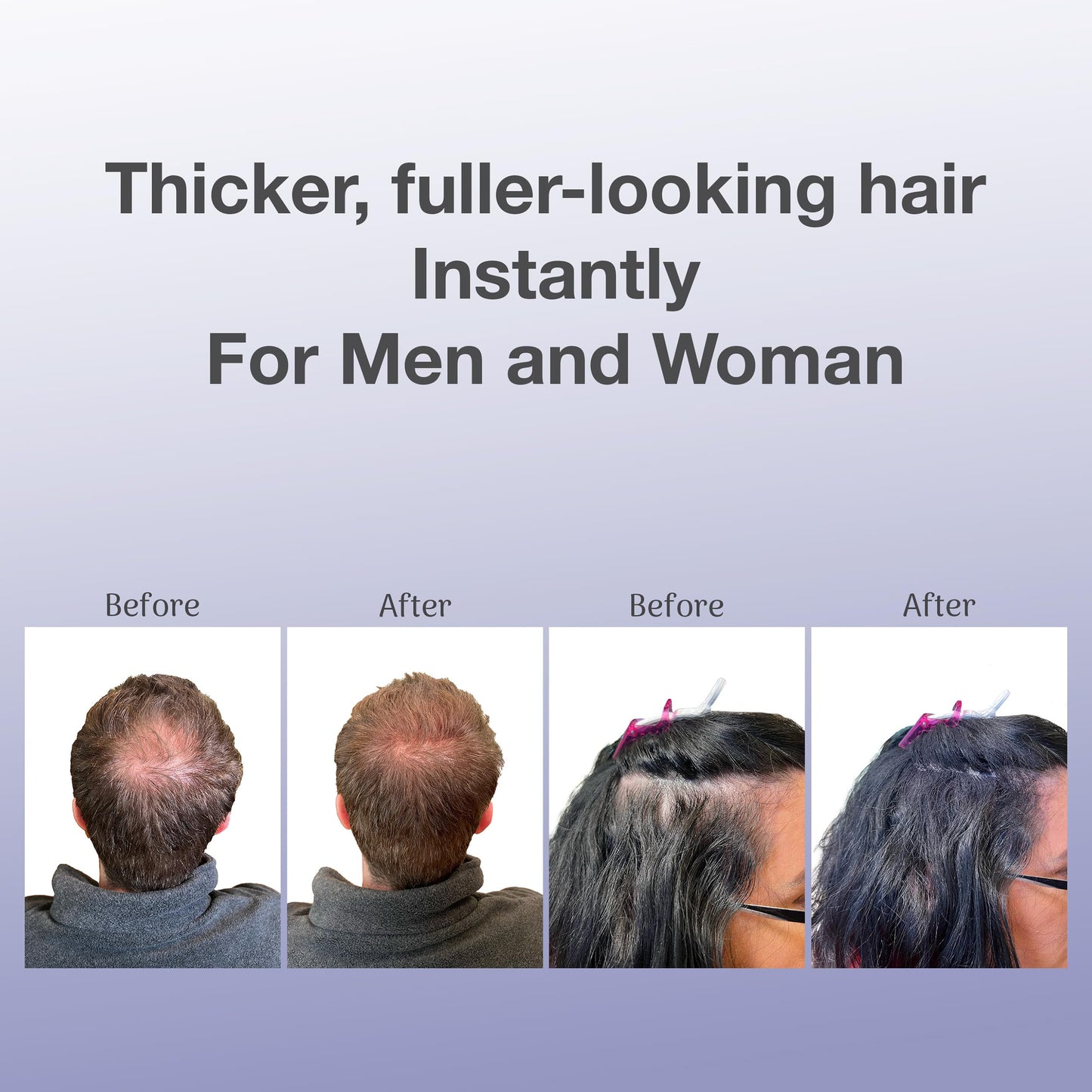 BosleyMD Professional Strength Hair Thickening Fibers, Medium Brown, 0.42 Ounce (Pack of 1)