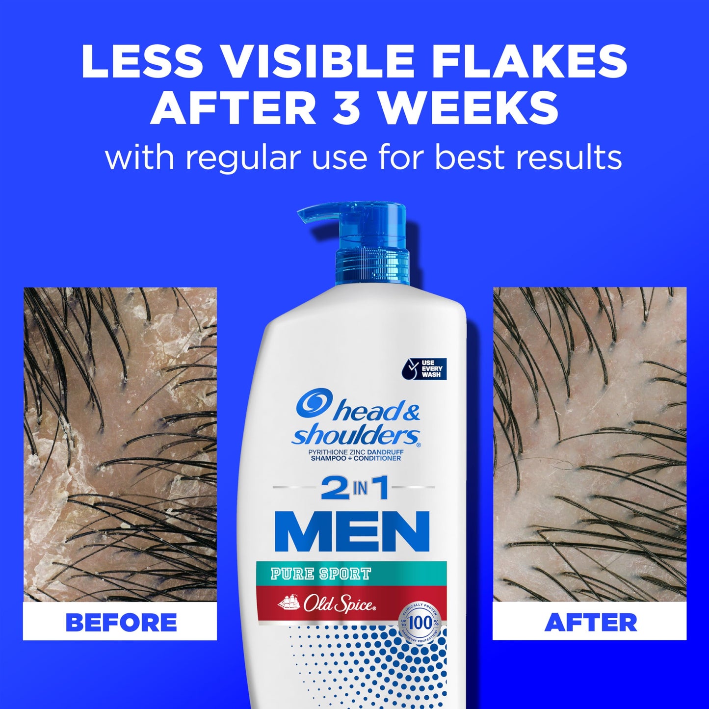 Head & Shoulders 2-in-1 Dandruff Shampoo + Conditioner Set, Old Spice Pure Sport Lemon-Lime Scent, Itch Relief & Scalp Care, 31.4 Fl Oz, 2 Pack