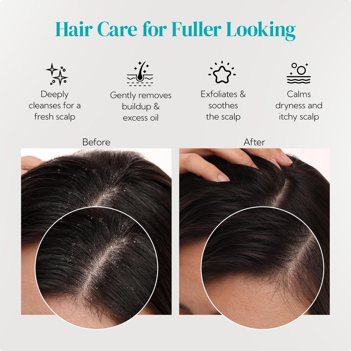 HEETA Scalp Massager Shampoo Brush 2-Pack – Soft Silicone Bristles for Deep Clean & Dandruff Removal, Wet/Dry Hair Scrubber for Men & Women (Green & Black)