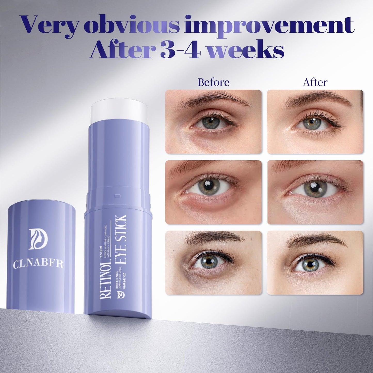 Retinol Eye Stick, Under Eye Balm for Dark Circles and Puffiness, Anti Aging Caffeine Cream Reduces Fine Lines, Wrinkles Moisturizer Stick (0.24oz/7g)