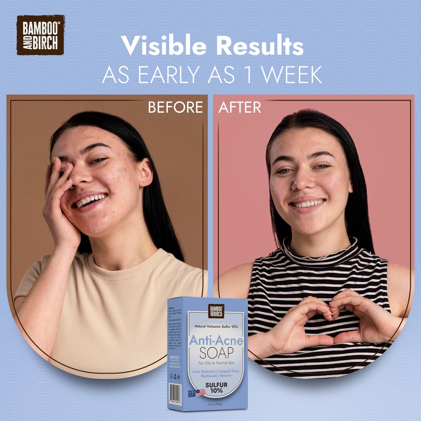 BAMBOO & BIRCH Sulfur Acne Soap Bar 10% with Salicylic Acid – Face & Body, Reduces Oil & Pimples, 3.5 oz, All Skin Types