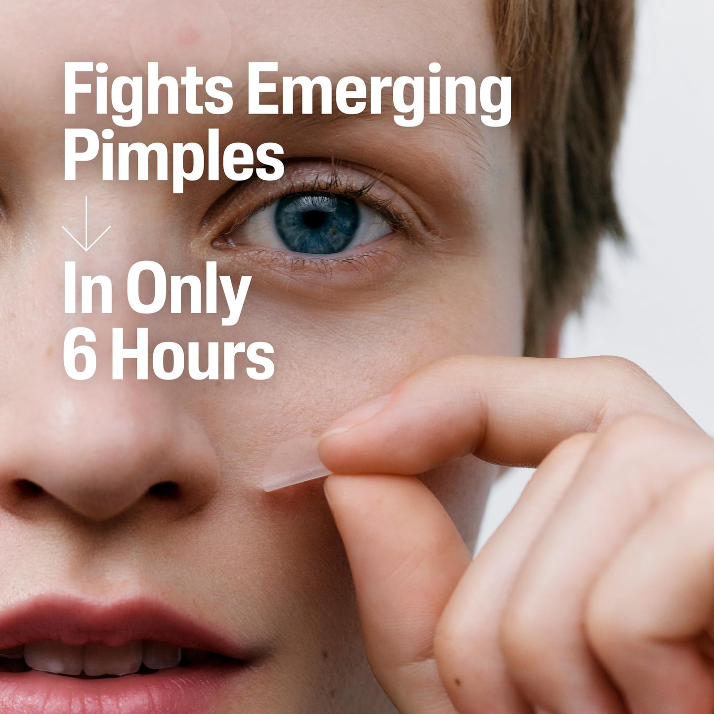 Cetaphil Acne Patches for Sensitive Skin – Salicylic Acid, CICA & Heartleaf Extract, Reduces Pimples in 6 Hours, 24 Count