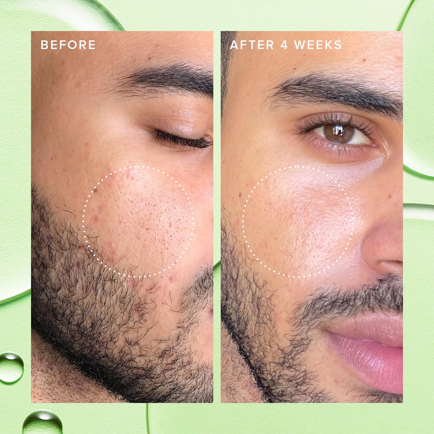 Farmacy 2% Salicylic Acid Toner – Gentle BHA Exfoliant with Papaya Enzymes & Moringa Water for Oily Skin, Refines Texture, 120ml