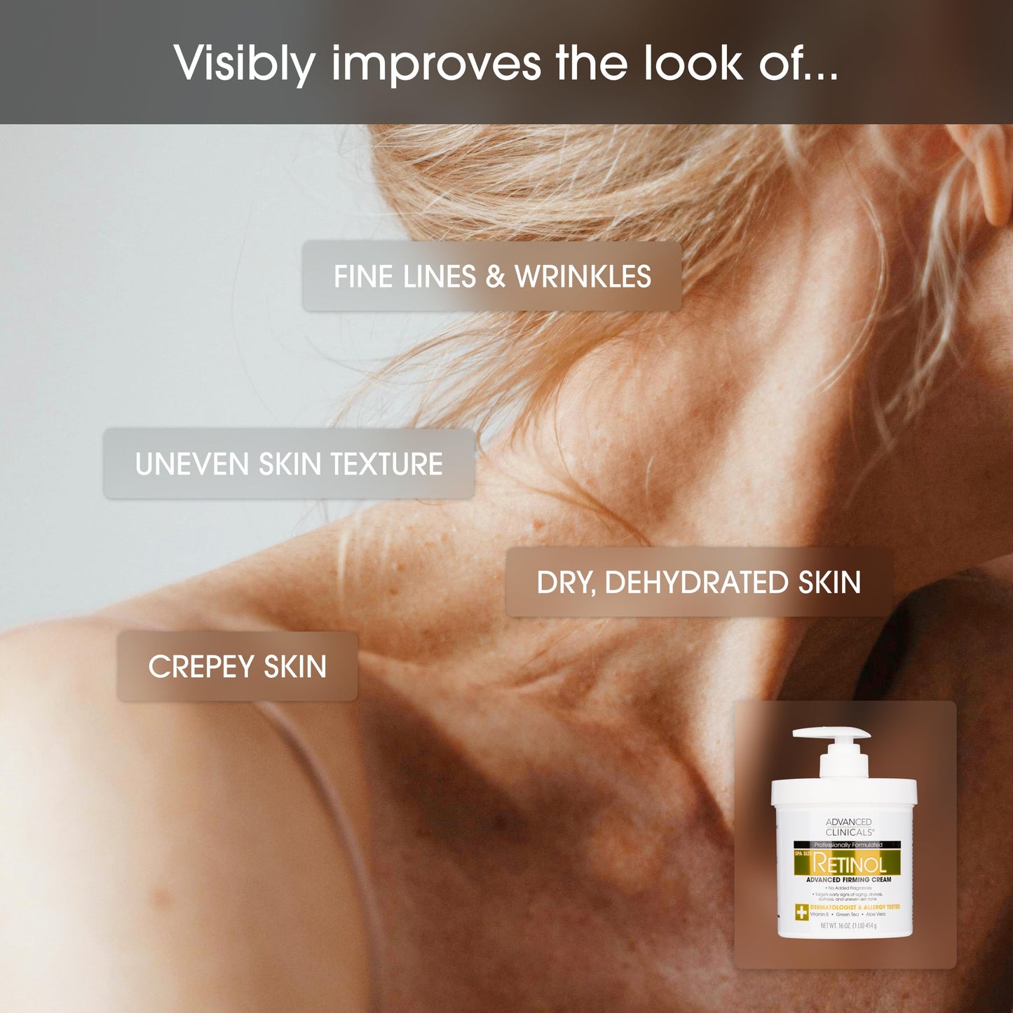 Advanced Clinicals Retinol Body & Face Lotion – Anti-Aging Moisturizer for Fine Lines, Wrinkles & Dry Skin, 16 oz, Women & Men