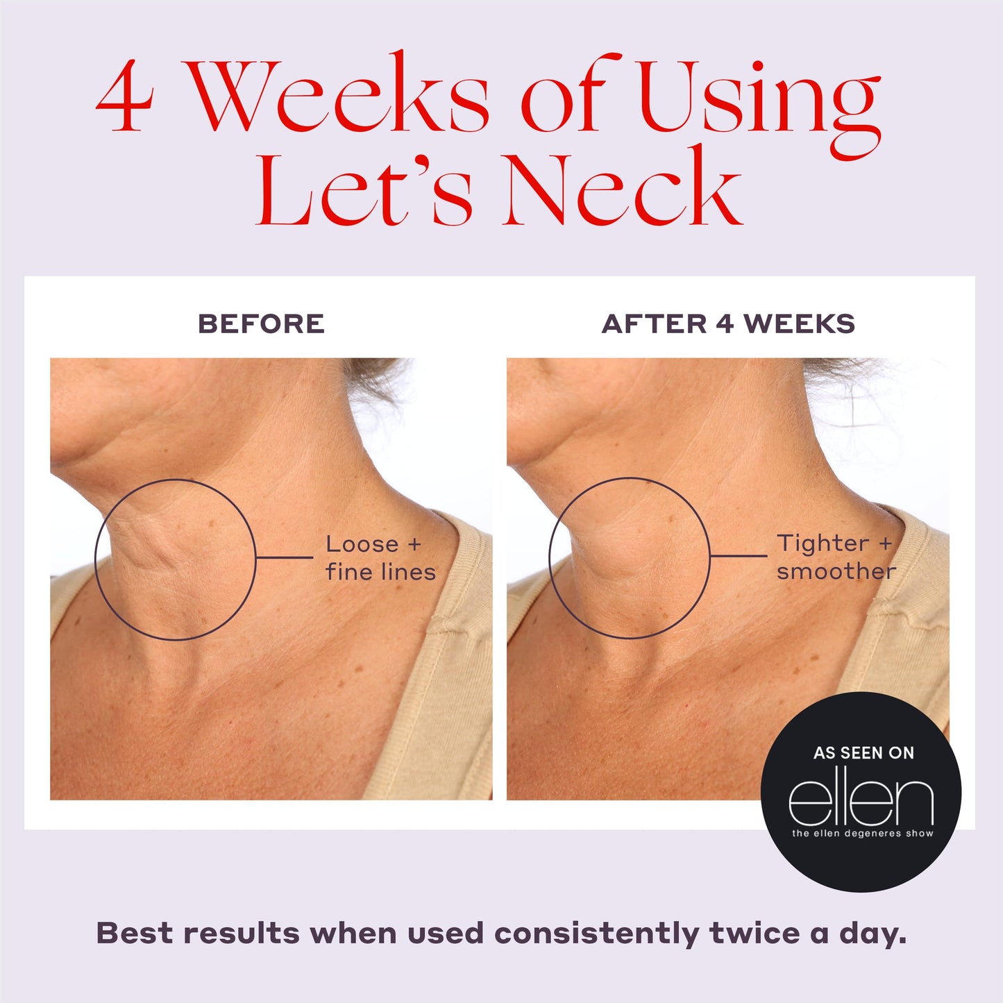 Womaness Let's Neck Firming Serum with Cooling Roller – Hydrates, Lifts & Smooths Wrinkles, Tightens Sagging Skin, 50ml