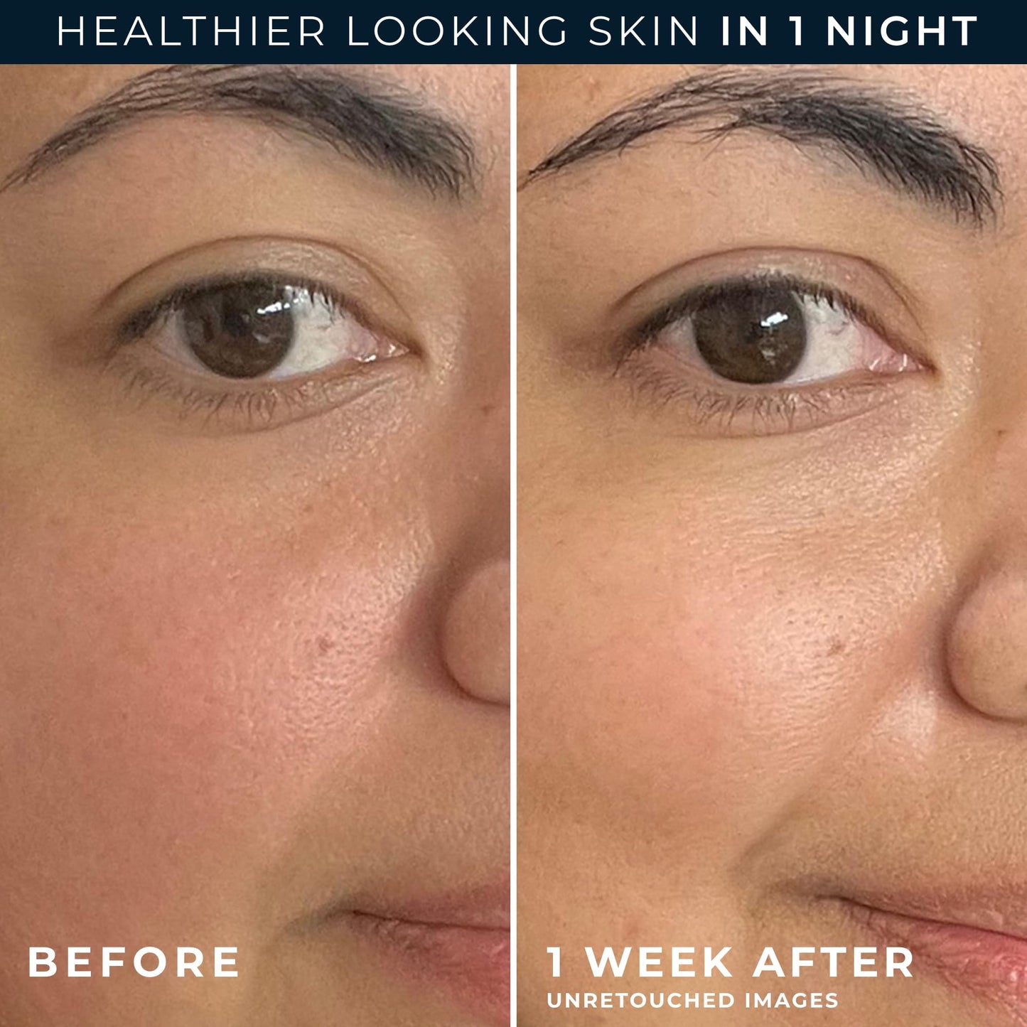 RoC Barrier Renew Night Moisturizer 2.5oz with Ceramides, Green Tea & Lipo Peptides + Retinol Eye Cream Packette for Skin Renewal