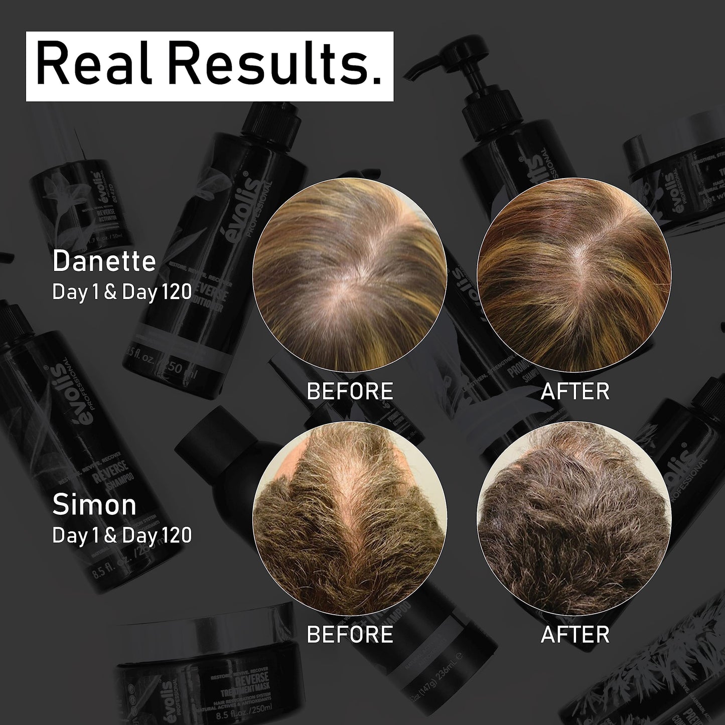 EVOLIS Prevent Anti-Aging Conditioner – Natural Hair Loss Prevention for Men & Women, Nourishes Dry or Oily Scalp, Strengthens Hair, 8.5 fl oz