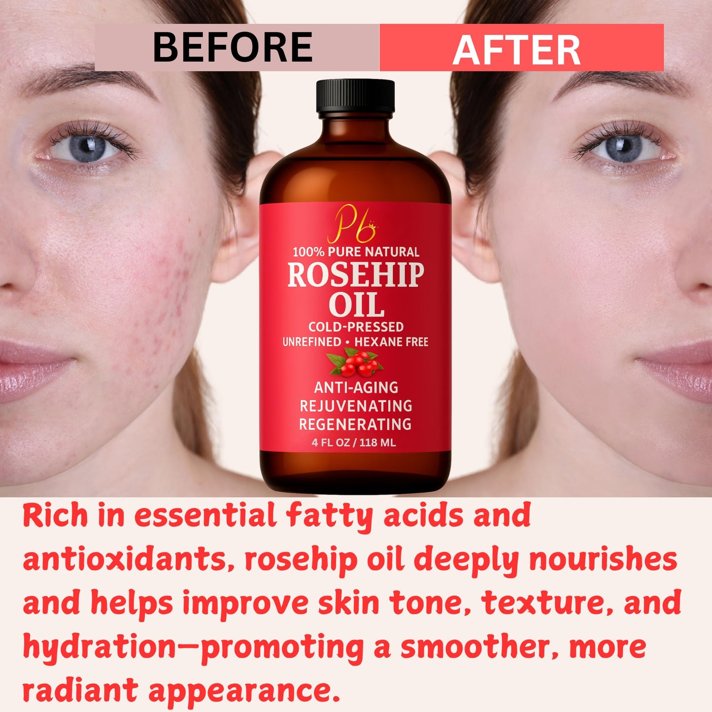 Pomberries Rosehip Oil – Cold-Pressed & Unrefined, Face, Skin & Hair Oil for Scars, Wrinkles, Stretch Marks, Daily Hydration & Massage, 4 fl oz