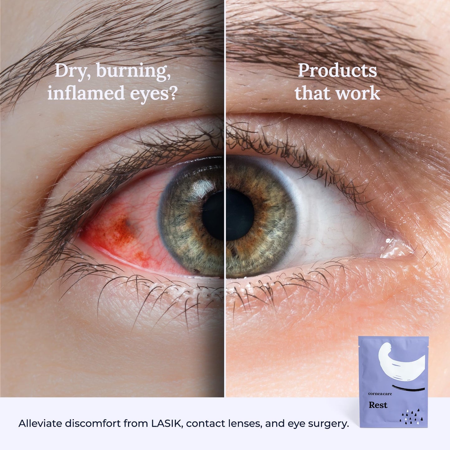 CorneaCare Rest Self-Heating Warm Eye Compress for Dry Eyes Relief – Heated Mask, No Microwave Needed, Travel Friendly, 30 Count