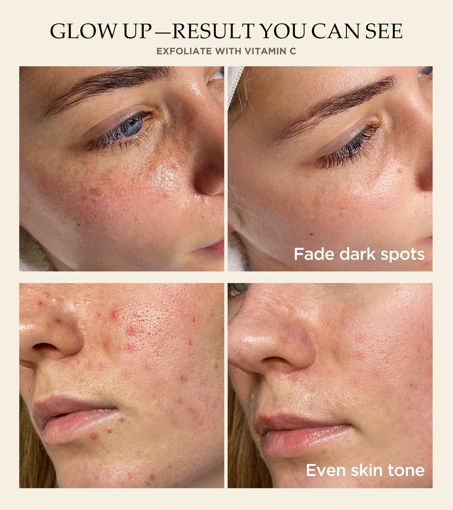 Vitamin C & Turmeric Face Scrub β Exfoliating Scrub for Face & Body, Anti-Aging, Clears Blackheads & Dark Spots, All Skin Types, 4.23 oz