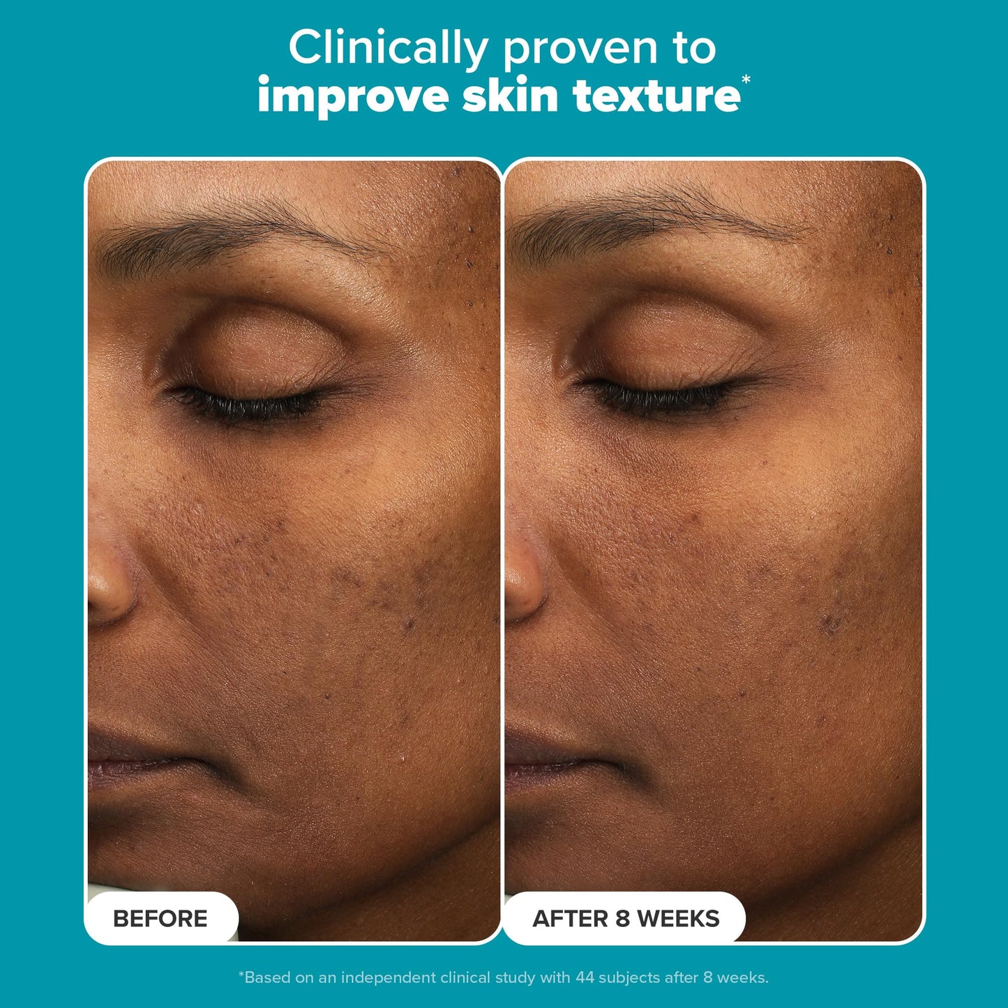 Paula’s Choice Mandelic + Lactic Acid Exfoliant 6%/2% – Gentle Daily AHA for Discoloration, Texture & Radiance, Sensitive Skin, 3 fl oz