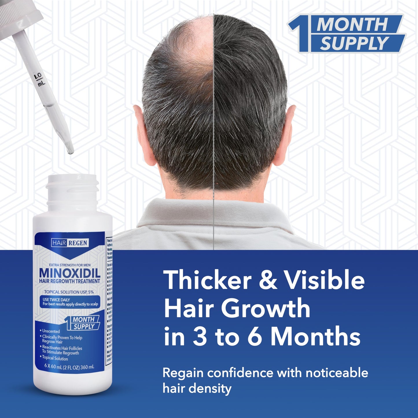 Hair-Regen 5% Minoxidil for Men – Hair Regrowth Treatment for Thinning Hair, 6-Month Supply, Thicker Fuller Hair