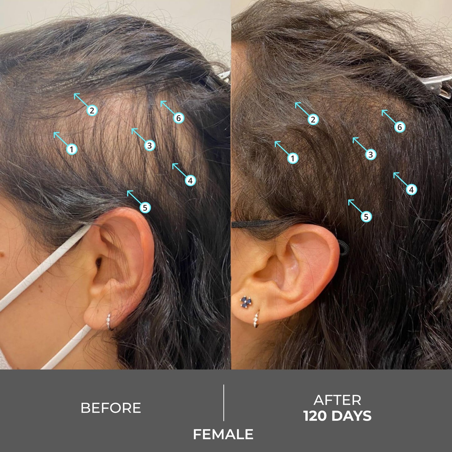 DS Labs Revita Extra Strength Shampoo 205mL – Promotes Fuller, Thicker Hair, Lightweight Hydration, Sulfate-Free & Color-Safe Formula for Men & Women