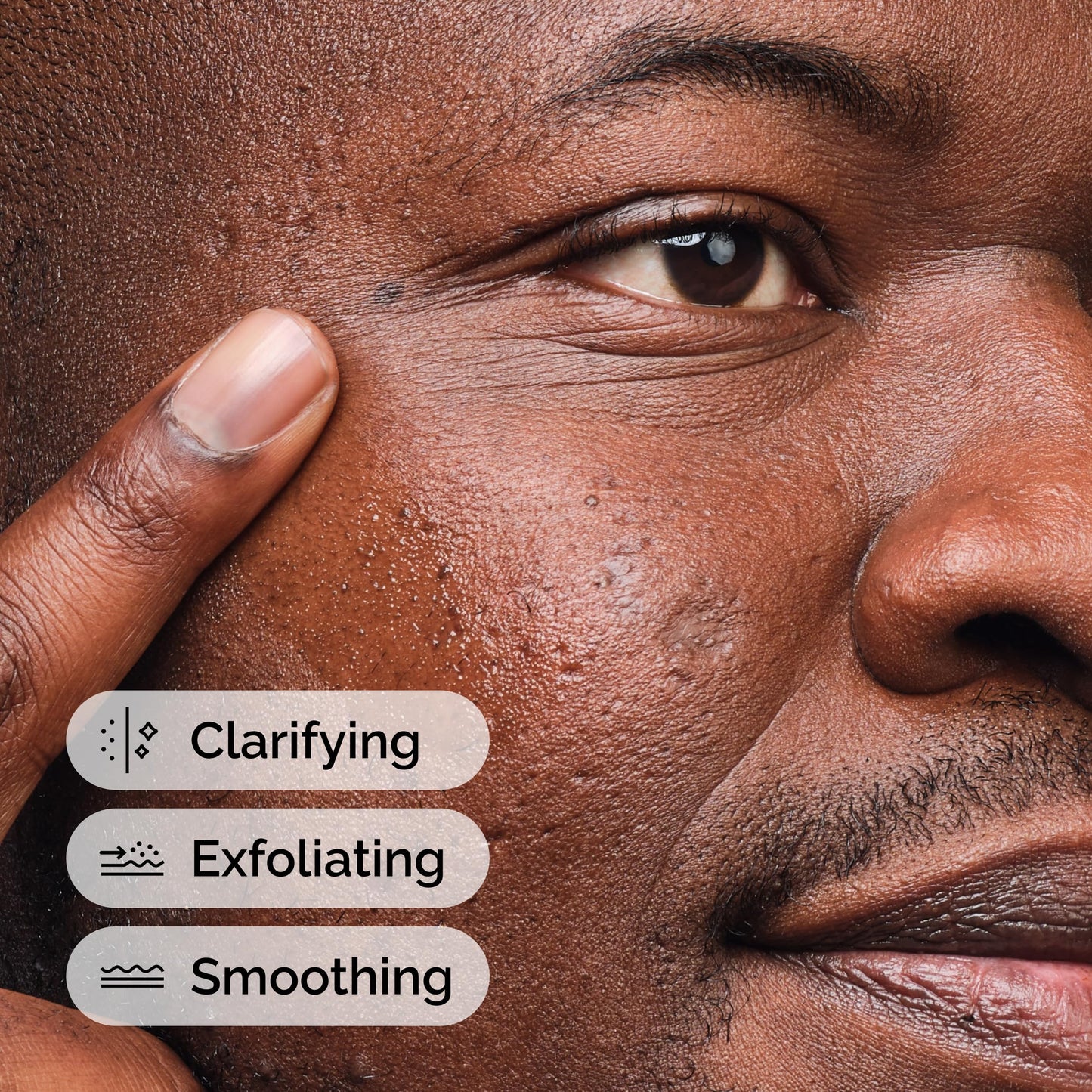 The Ordinary Salicylic Acid 2% Solution, Acne-Fighting Serum for Blemish-Prone Skin, 1 Fl Oz