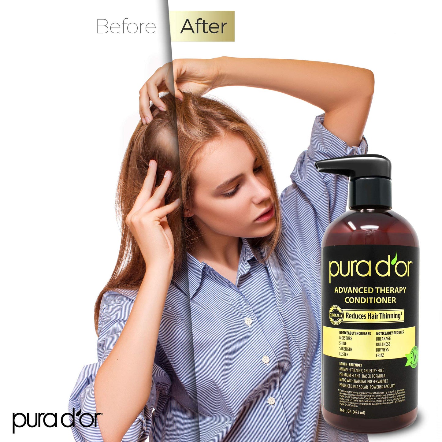 PURA D'OR Advanced Therapy Conditioner 16oz | Moisture, Strength & Volume Boost | Argan Oil & Biotin | Sulfate-Free for All Hair Types