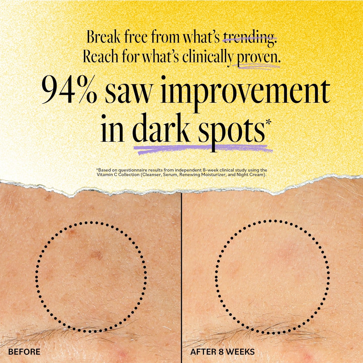 DERMA-E Vitamin C Intense Night Cream – Brightening and Hydrating Facial Skin Renewing Cream – Anti-Aging Overnight Facial Moisturizer, 2 oz