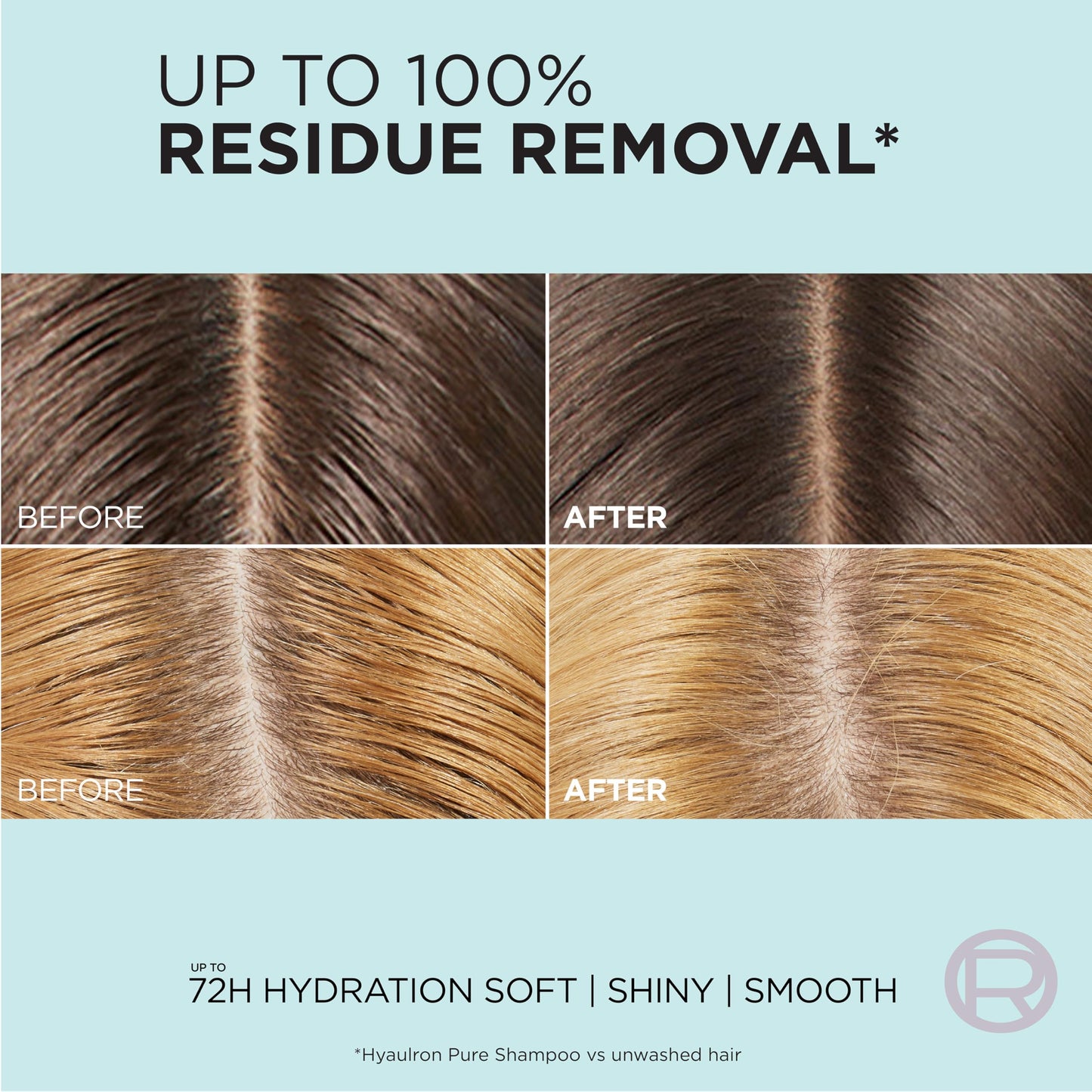 L'Oreal Paris Elvive Hyaluron + Pure Shampoo & Conditioner Set | Clarifying & Rehydrating Hair Care with Salicylic & Hyaluronic Acid, 1 Kit