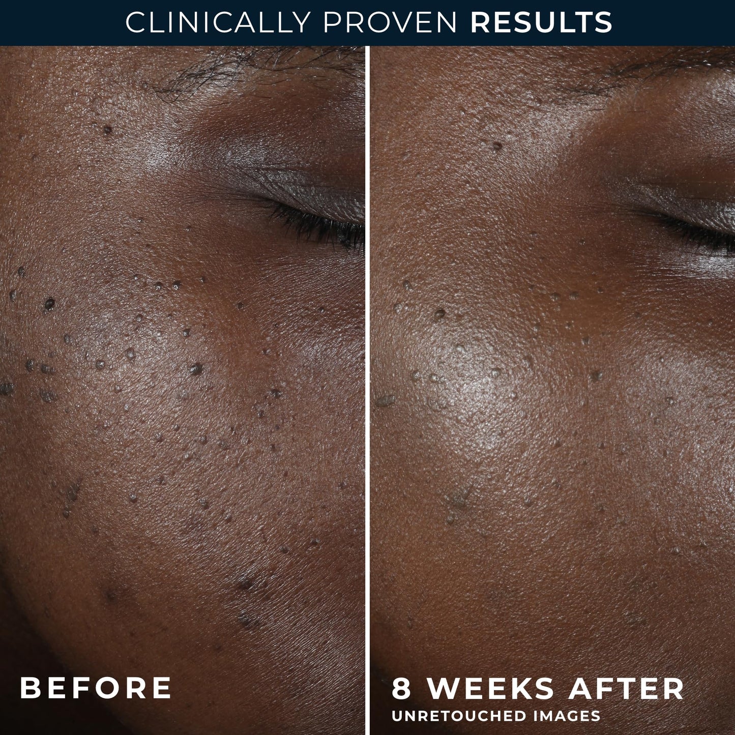 RoC Multi Correxion 5 in 1 Restoring, Anti Aging Night Cream for Face with Hexinol, 1.7 Ounces (Packaging May Vary)