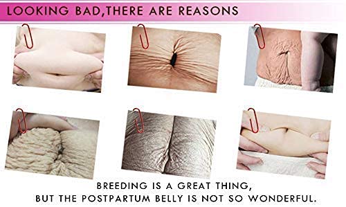 RtopR Mango Stretch Marks and Scar Cream -Stretch Marks and Scar Removal Cream for Pregnancy - Best Body Moisturizer-40g