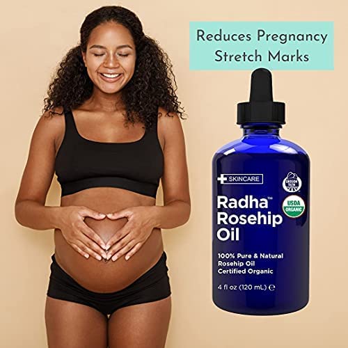 Radha Beauty Organic Rosehip Seed Oil 4 oz – 100% Pure Cold Pressed Carrier Oil for Face, Hair, Skin & Nails – Hydrating & Nourishing